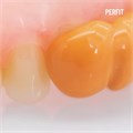 PERFIT Light Body-Корригирующий слой (2х50мл) без насадок, VINCISMILE BY HUGE DENTAL 1231915334 - фото 449050