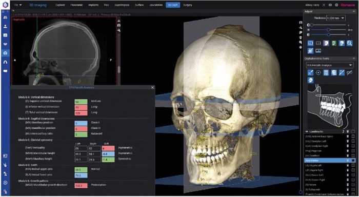 Программное обеспечение Planmeca Romexis 3D Cephalometric Analysis, лицензия на 1 пользователя FE004915 - фото 357505