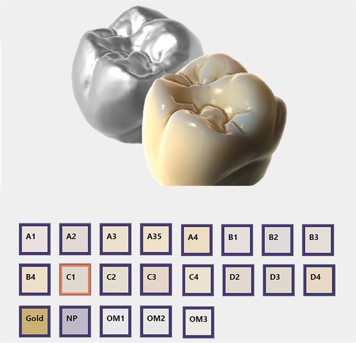 Модуль Exocad Trusmile. Модуль для естественной визуализации реставраций Trusmile - фото 361038