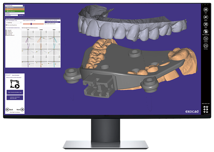 Модуль Exocad Jaw Motion Import.Импорт движения челюсти JawMotionImport - фото 361043