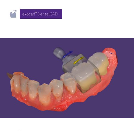 Exocad Modul Nesting (incl. In-CAD Nesting) 265222 - фото 401310