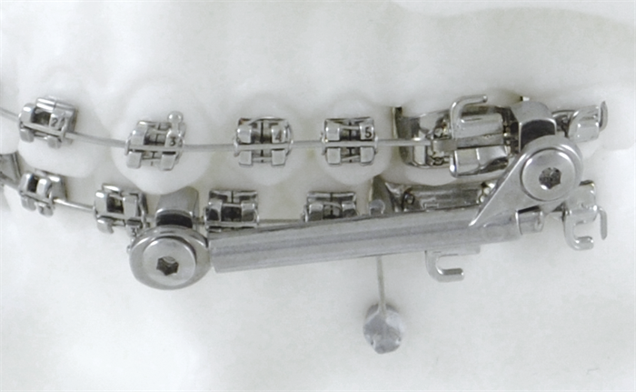 Аппарат Гербста 2 74924 - фото 452243