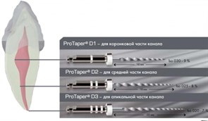 ProTaper Retreatment  D1 (6 шт.)- для распломбировки каналов 00000909827