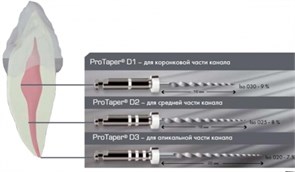 ProTaper Retreatment D1-D3 асс. (D1х2, D2х2, D3х2) - для распломбировки каналов 00000002539