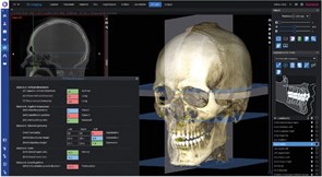 Программное обеспечение Planmeca Romexis 3D Cephalometric Analysis, лицензия на 1 пользователя FE004915