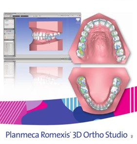 Программное обеспечение Planmeca Romexis 3D Ortho Studio Advanced FE004327