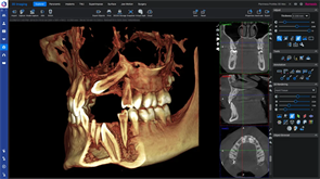 Программное обеспечение Planmeca Romexis 3D imaging FE004309