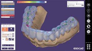 Модуль Exocad Bite splint module. Модуль шинирования зубов bitesplintmodu