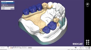 Модуль Exocad Partial Framework Module. Модуль создания бюгелей PartialFrameworkModule