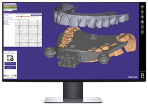 Модуль Exocad Jaw Motion Import.Импорт движения челюсти JawMotionImport