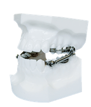 Аппарат Гербста 1 74937