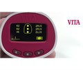 Спектрофотометр VITA Easyshade V DEASY5 - фото 356995