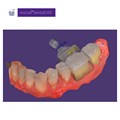 Обновления программного обеспечения для Exocad, модуль nesting (включая In-CAD Nesting) 265318 - фото 401335