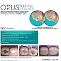 Opus Bulk Fill Flow APS A2, Шприц (2гр), FGM 1231914428 - фото 454158