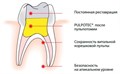 Pulpotec, PD 00000002483 - фото 454590