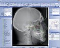 Ортопантомограф Planmeca ProMax 2D SCARA 2. 10030688 - фото 476724