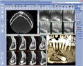 Томограф Planmeca ProMax 3D Plus без цефалостата 10032801 - фото 476781