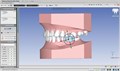 Томограф Planmeca ProMax 3D Plus без цефалостата 10032801 - фото 476786