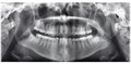 Ортопантомограф Planmeca ProMax 2D SCARA 3 10019565 - фото 476796
