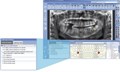 Томограф Planmeca ProMax 3D Mid без цефалостата 10026081 - фото 476799