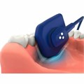 Радиовизиограф EzSensor Soft EzSensor-Soft - фото 481950