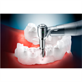 OneGuide Kit - набор для навигационной хирургии Osstem OOGK - фото 488581