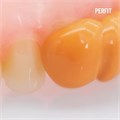 PERFIT Light Body-Корригирующий слой (2х50мл) без насадок, VINCISMILE BY HUGE DENTAL 1231915334 - фото 493044