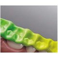 Greenbite colour материал для регистрации прикуса (2х50мл), Detax (Германия) 0001914449 - фото 493096