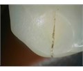 Durr Dental VistaCam IX - интраоральная видеокамера с головками Cam, Proof, Proxi 2108-05 - фото 495593