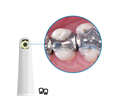 Durr Dental VistaCam IX - интраоральная видеокамера с головкой Cam 2108-02 - фото 495608