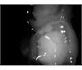 Durr Dental VistaCam IX - интраоральная видеокамера с головками Cam, Proxi 2108-06 - фото 495678