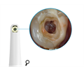 Durr Dental Macro - сменная насадка для VistaCam IX 2108-130-54 - фото 495683
