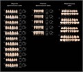 Зубы акриловые ANIS PROFI 3-х слойные №44 B1 фронтальные нижние, 6шт, АНИС УТ-00004848 - фото 522863